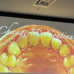 皆川インプラントアカデミー総会2019  　「大阪府豊中市岡町の歯医者・歯科審美学会認定医・まつもと歯科」
