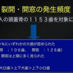 マイクロスコープアドバンスコース受講（歯周病について）　「大阪府豊中市岡町の歯医者・歯科審美学会認定医・まつもと歯科」