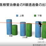 ICEED歯科臨床コース受講（歯内療法のコンセプトと診査診断）　「大阪府豊中市岡町の歯医者・歯科審美学会認定医・まつもと歯科」