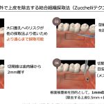 ICEED歯科臨床コース受講（歯周形成外科）　「大阪府豊中市岡町の歯医者・歯科審美学会認定医・まつもと歯科」