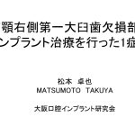 大阪インプラント研究会アドバンストセミナー受講　「大阪府豊中市岡町の歯医者・歯科審美学会認定医・まつもと歯科」