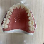 iCEED ダイレクトボンディングの歯科講義・実習　「大阪府豊中市岡町の歯医者・歯科審美学会認定医・まつもと歯科」