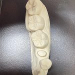 iCEED のオンレーベニアの歯科講義・実習　「大阪府豊中市岡町の歯医者・歯科審美学会認定医・まつもと歯科」